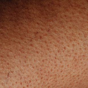 Hot Mode: Open, Absorb & Relax