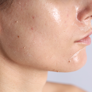 Cold Mode: Firm, Depuff & Sculpt